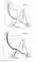 Fig. 09 - Unitary body systems and devices and methods to use the same for retroperfusion