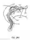 Fig. 20 - Unitary body systems and devices and methods to use the same for retroperfusion