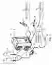 Fig. 02 - Surgical fluid management system