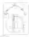 Fig. 16 - Apparatus, kits and related methods for fluid infusion