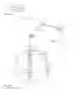 Fig. 17 - Apparatus, kits and related methods for fluid infusion