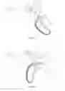 Fig. 31 - Apparatus, kits and related methods for fluid infusion