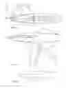 Fig. 41 - Apparatus, kits and related methods for fluid infusion