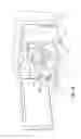 Fig. 48 - Apparatus, kits and related methods for fluid infusion