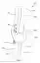 Fig. 06 - Safety syringe and methods for administration of a medicament dose by subject weight