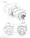 Fig. 05 - Drug delivery device
