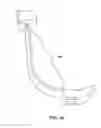 Fig. 34 - FLEXIBLE TUBE HOLDING DEVICE AND INTUBATION SYSTEM WITH METHODS OF USE