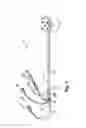 Fig. 02 - THROMBECTOMY AND BALLOON ANGIOPLASTY/STENTING DEVICE