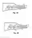 Fig. 05 - Methods and devices for treating sinusitis