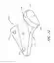 Fig. 12 - Medical connector