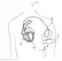 Fig. 01 - Medical device with surface mounted lead connector