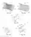 Fig. 03 - Cardiac or cerebral vessel microlead with electrode ring