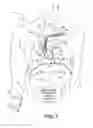 Fig. 02 - MEDICAL DEVICE TO PROVIDE BREATHING THERAPY