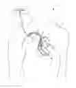 Fig. 01 - Criteria for optimal electrical resynchronization during biventricular pacing