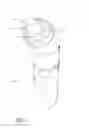 Fig. 14 - Device and method for treating allergic rhinitis