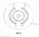 Fig. 15 - Device and method for treating allergic rhinitis