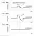 Fig. 11 - Exercise information display system, exercise information display method and computer-readable recording medium