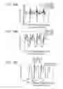 Fig. 17 - Exercise information display system, exercise information display method and computer-readable recording medium