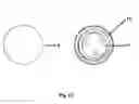 Fig. 15 - Golf club with insert.