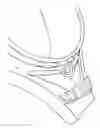 Fig. 01 - LACROSSE POCKET STRING LOCK