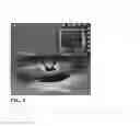 Fig. 06 - Microfluidic devices and methods for cell processing