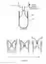 Fig. 16 - Method and system for buoyant separation