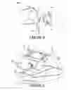 Fig. 05 - Method for machining a casing of an aircraft turboshaft engine and scraper tool for implementing said method
