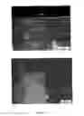 Fig. 06 - METHOD OF CLADDING, ADDITIVE MANUFACTURING AND FUSION WELDING OF SUPERALLOYS AND MATERIALF OR THE SAME