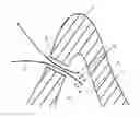 Fig. 01 - METHOD FOR LASER BORING OR LASER CUTTING A WORKPIECE