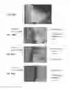 Fig. 07 - METHOD FOR JOINING METALLIC MEMBERS, JOINT STRUCTURE AND BRAZING FILLER METAL