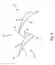 Fig. 05 - DIRECT DEPOSITION OF METALLIC COATING