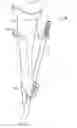 Fig. 01 - Arm holder for a pole-handled tool