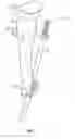 Fig. 02 - Arm holder for a pole-handled tool