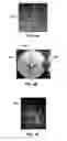 Fig. 04 - Additive manufacturing of embedded materials
