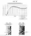 Fig. 11 - Liquid ejecting apparatus