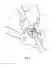 Fig. 04 - FOLDED TROLLEY STRUCTURE AND TROLLEY