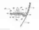Fig. 01 - Plastic panel attachment joint for fascia to fender execution