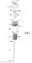 Fig. 05 - Telescopic suspension device fitted with a pretension tracking system