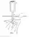 Fig. 10 - Marker and recovery device