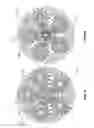Fig. 09 - Rotor assembly apparatus