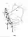Fig. 06 - Collapsible hoisting apparatus