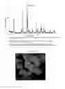 Fig. 02 - Photocatalysts based on bismuth oxyhalide, process for their preparation and uses thereof