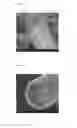 Fig. 09 - Inorganic fibre compositions