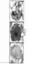 Fig. 06 - NOVEL BISAMINOQUINOLINE COMPOUNDS, PHARMACEUTICAL COMPOSITIONS PREPARED THEREFROM AND THEIR USE