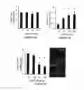 Fig. 16 - NOVEL BISAMINOQUINOLINE COMPOUNDS, PHARMACEUTICAL COMPOSITIONS PREPARED THEREFROM AND THEIR USE