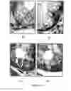 Fig. 17 - NOVEL BISAMINOQUINOLINE COMPOUNDS, PHARMACEUTICAL COMPOSITIONS PREPARED THEREFROM AND THEIR USE