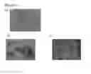 Fig. 03 - Preparation of and formulation comprising a MEK inhibitor