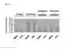 Fig. 10 - IRE-1α inhibitors