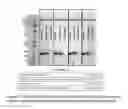 Fig. 04 - Chromatography matrices including novel protein a based ligands