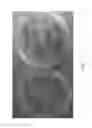 Fig. 05 - Biological devices and methods of use thereof for the study and control of alzheimer's disease